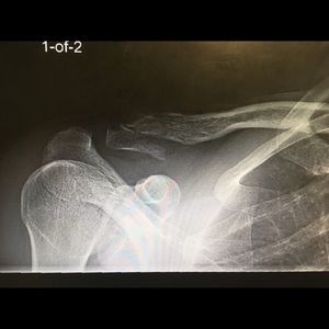 Meet your Posher, Ray